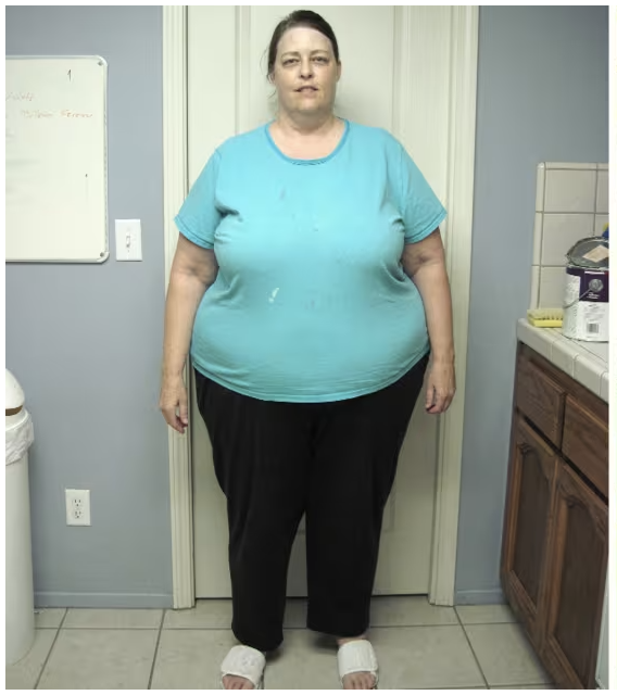 Judy Before